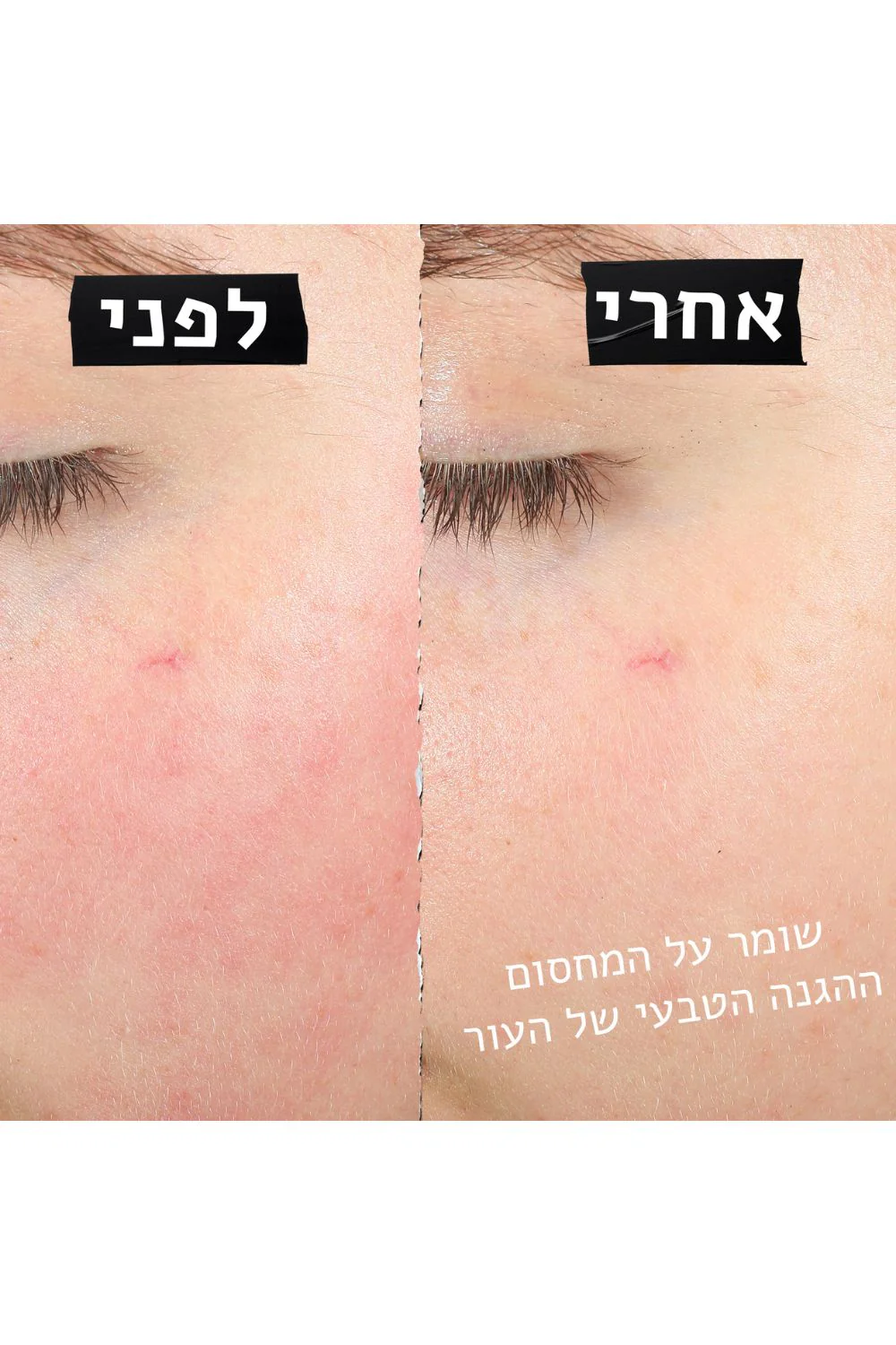 קרם פנים משקם לעור רגיש 50 מ"ל | קיל'ס - Image 5