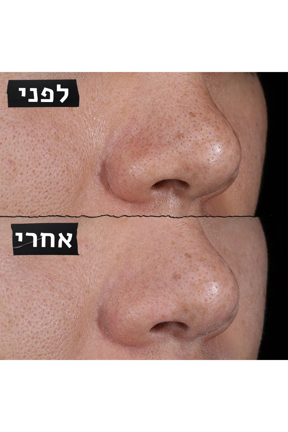 מסכת חימר לצמצום מראה הנקבוביות 125 מ"ל | קיל'ס - Image 6