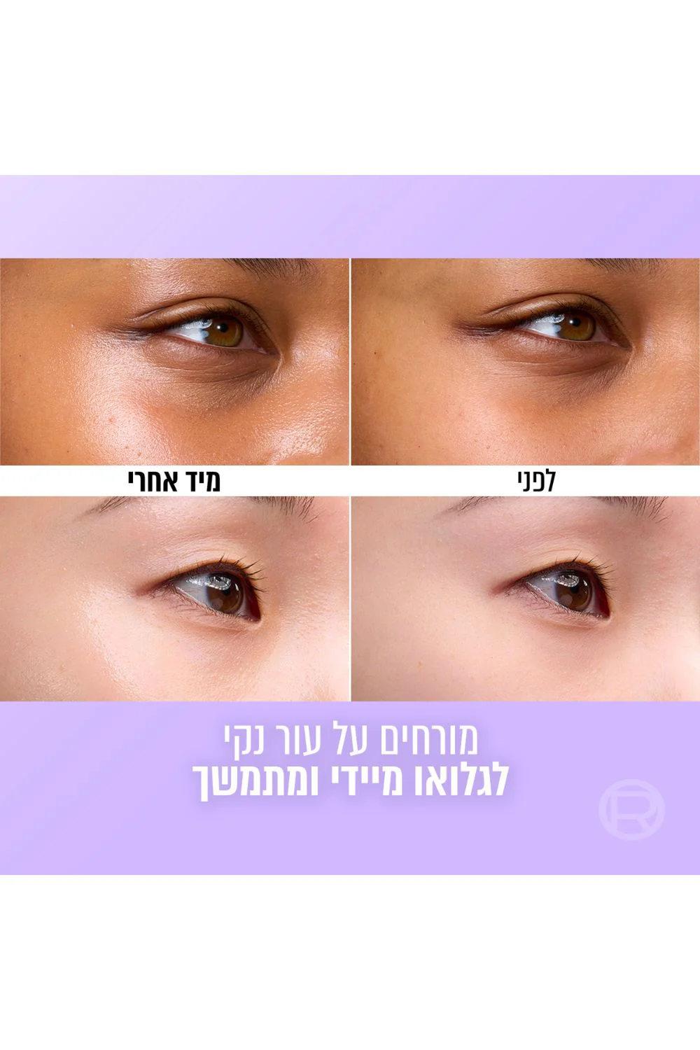 קרם לחות למראה עור זכוכית 50 מ"ל Revitalift filler | לוריאל - Image 5
