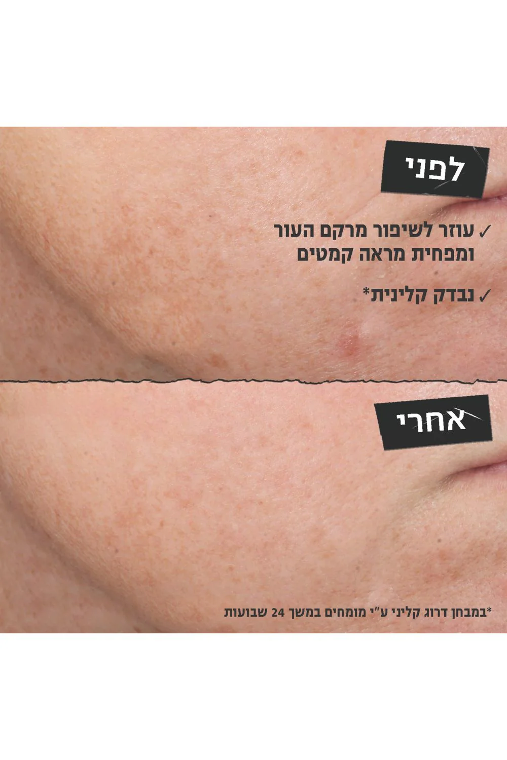 סרום רטינול 30 מ"ל - Image 5