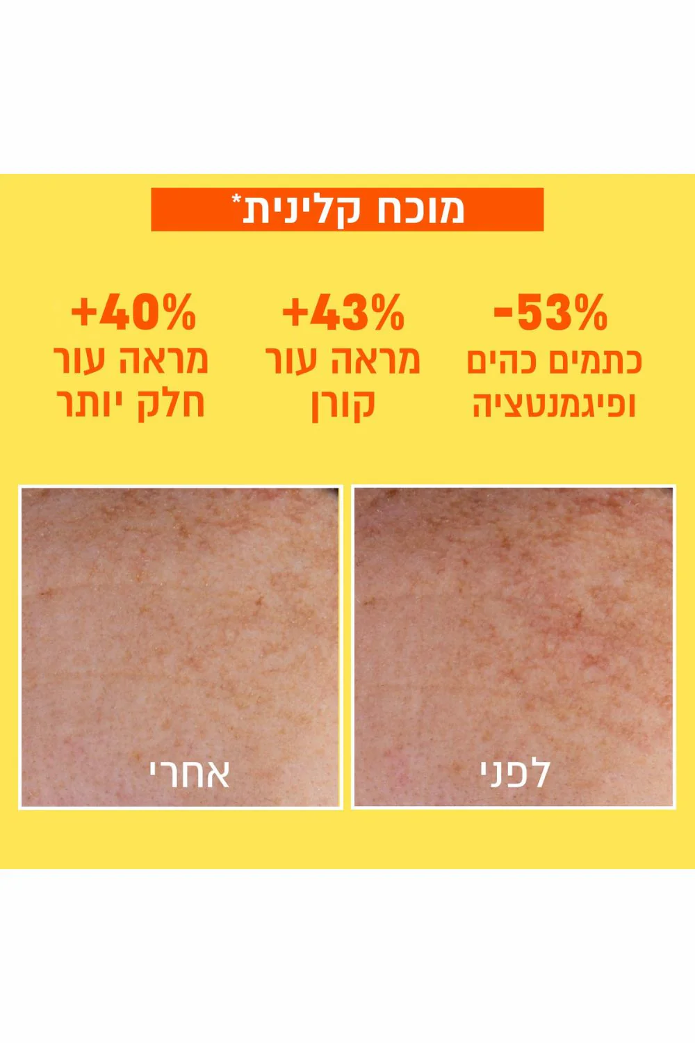 תחליב לחות UV ויטמין C אינביזיבל 40 מ"ל - Image 2